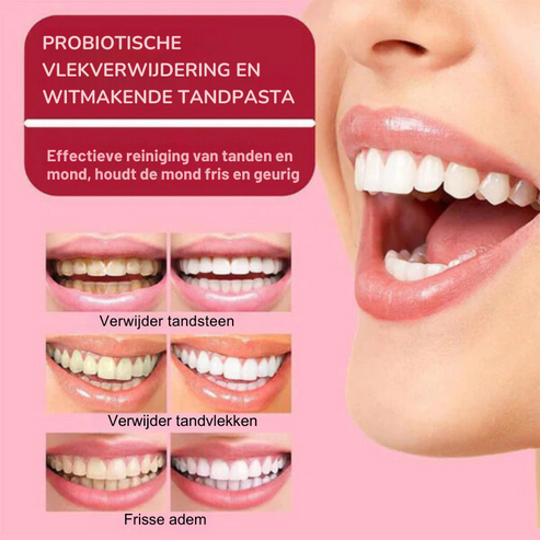 YAYASHI Probiotische Witte Tandpasta